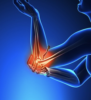 Pain in elbow. Tennis elbow is an overuse injury